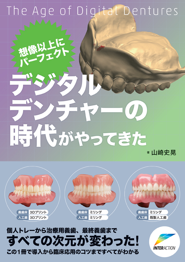 10年以上天然歯を守ったパーシャルデンチャーはここが違う: その