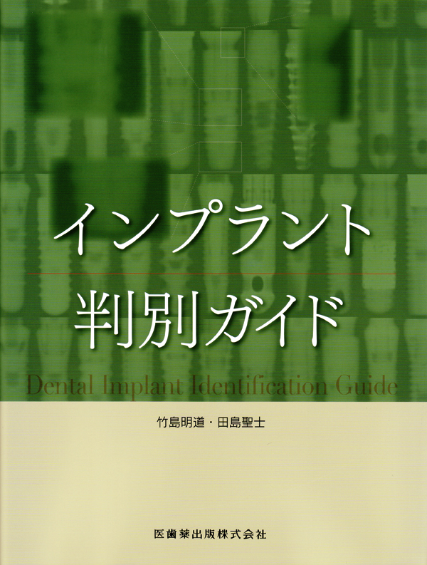 シエン社 | インプラント判別ガイド シエン社 | インプラント判別ガイド