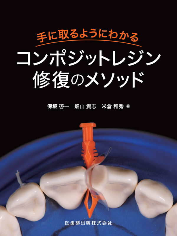 Amazon.co.jp: 手に取るようにわかるコンポジットレジン修復の