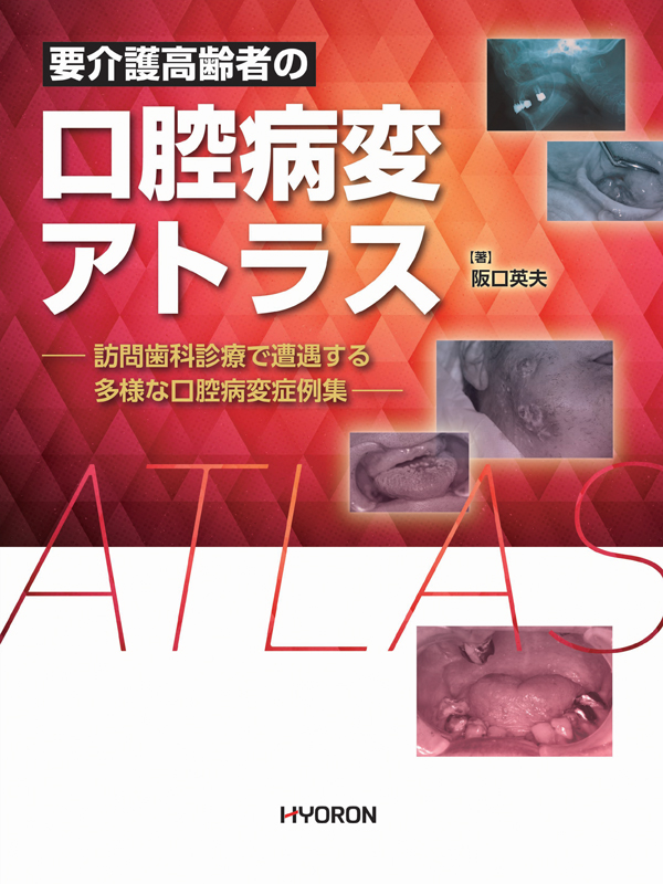 口腔病変診断アトラス シエン社 | 要介護高齢者の口腔病変アトラス