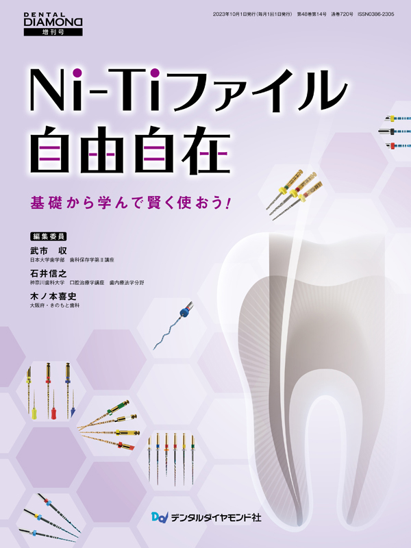 NiTiロータリーファイルを効果的に使う実践歯内療法 裁断済み Evidence & Technique NiTiロータリーファイルを効果的に使う