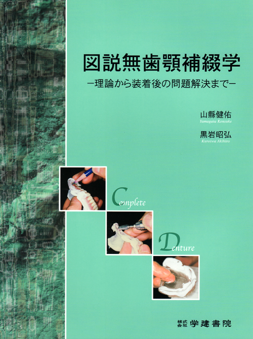 図説無歯顎補綴学 理論から装着後の問題解決まで