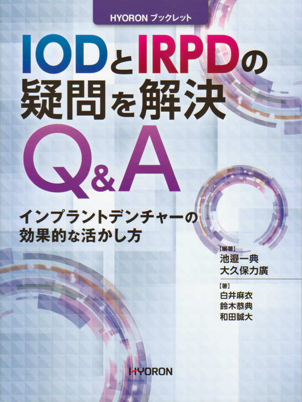 シエン社 | IODとIRPDの疑問を解決Q&A