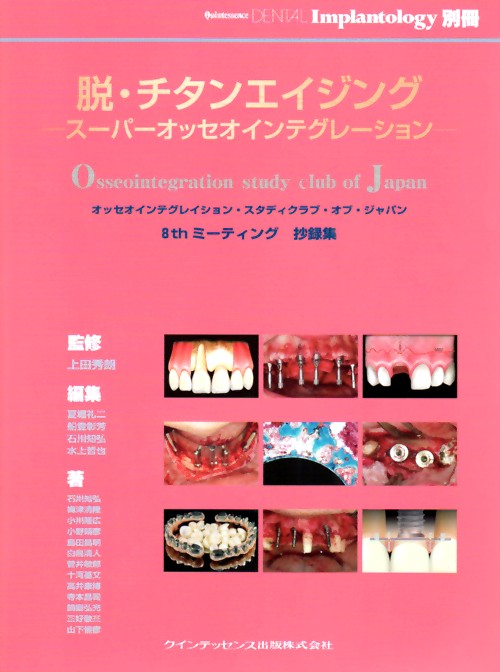 脱・チタンエイジング ス-パ-オッセオインテグレ-ション/クインテッセンス出版/夏堀礼二（単行本（ソフトカバー）） シエン社 | 脱・チタンエイジング スーパーオッセオ