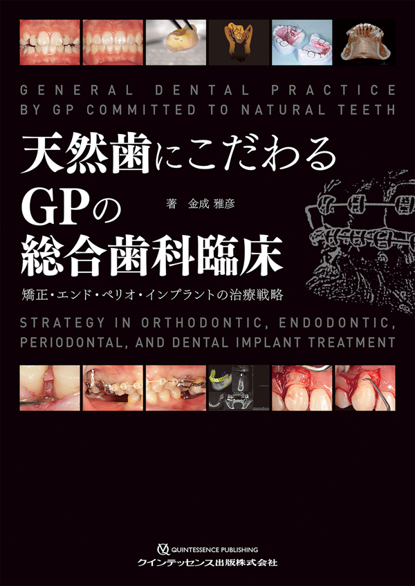 天然歯にこだわるGPの総合歯科臨床 = GENERAL DENTAL PRAC… シエン社 | 天然歯にこだわるGPの総合歯科臨床
