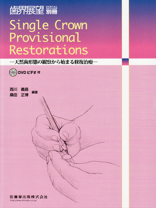 高品質 | シエン社 Single DVDビデオ付 Restorations Provisional Crown 洋書