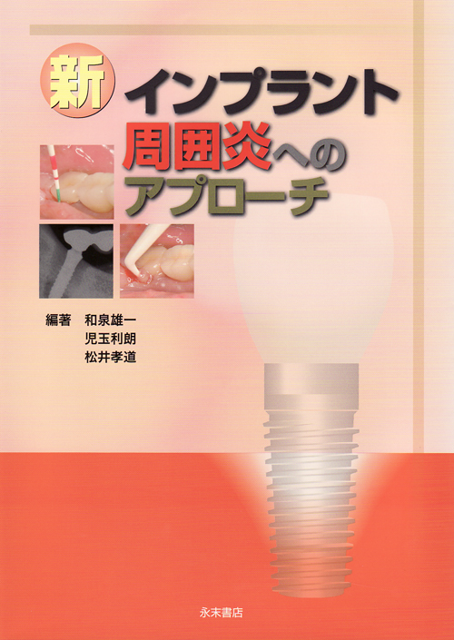 シエン社 | 新 インプラント周囲炎へのアプローチ