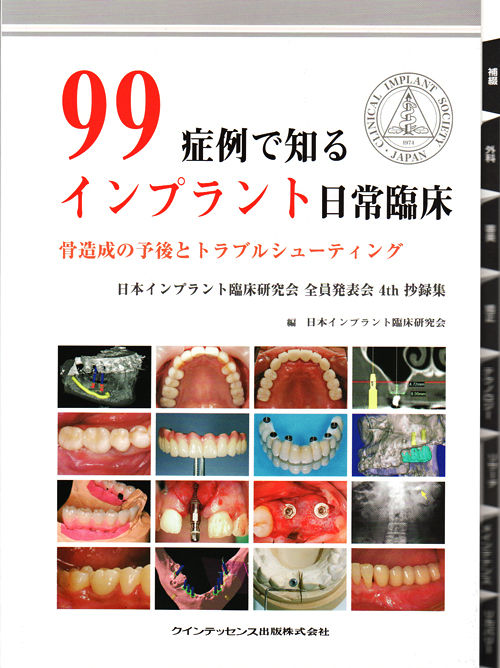 春の美しさのお気に入り、シンコ・デ・マヨのスタイルのヒント、歯科インプラントのオプション