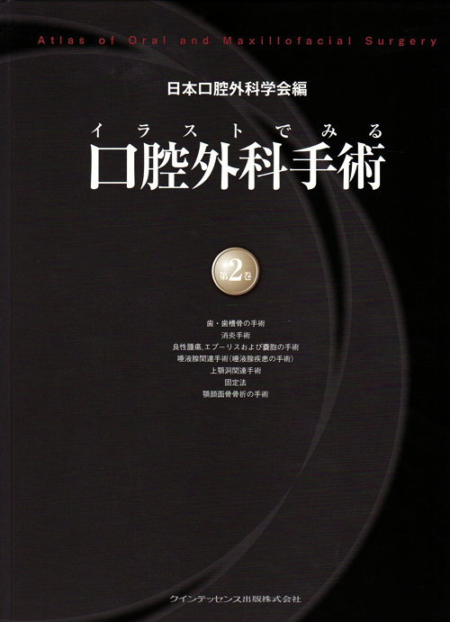イラストでみる口腔外科手術 第2版 イラストでみる口腔外科手術 第2巻 | 日本口腔外科学会, 野間