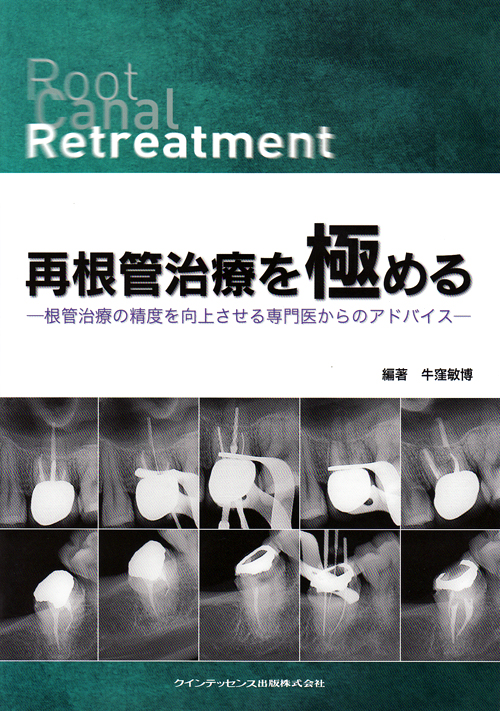 再根管治療を極める / 牛窪敏博 - 紀伊國屋書店ウェブストア