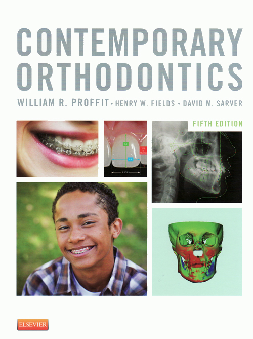 語学・辞書・学習参考書 PROFFIT/CONTENMPORARY ORTHODONTICS/fifth シエン社 | Contemporary Orthodontics <5th>