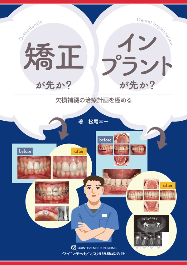 【裁断済み】生体にやさしい戦略的矯正歯科治療 生体にやさしい戦略的矯正歯科治療と歯科矯正用アンカー