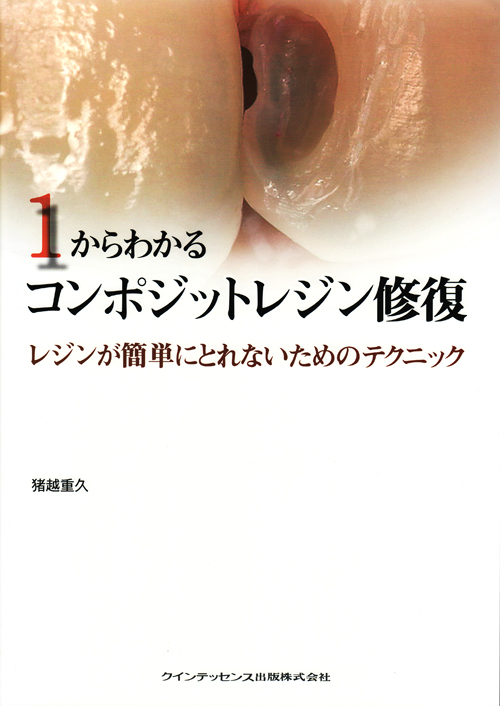 1からわかるコンポジットレジン修復　レジンが簡単にとれないためのテクニック 1からわかるコンポジットレジン修復 | 猪越 重久 |本 | 通販