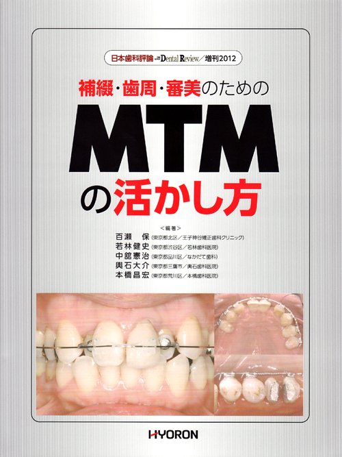 歯周補綴・治療のためのM.T.M シエン社 | 補綴・歯周・審美のためのMTMの活かし方
