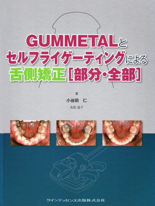 シエン社 | GUMMETALとセルフライゲーティングによる舌側矯正