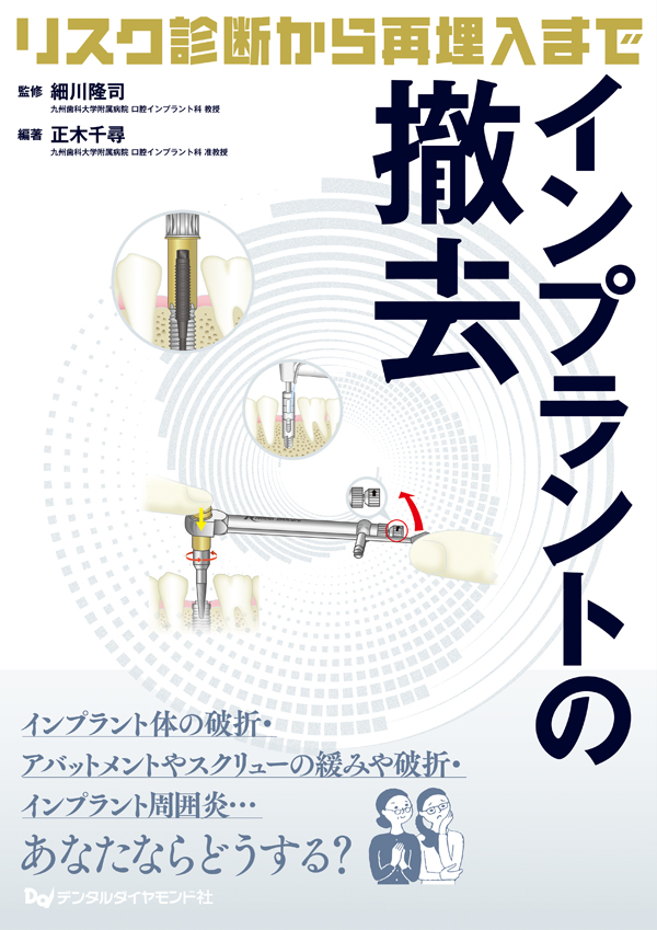 インプラントの撤去 911kit_16.jpg