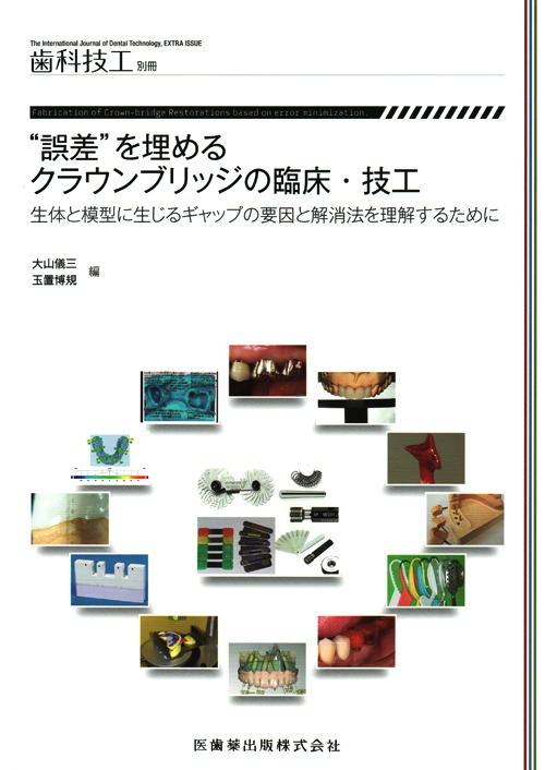 シエン社 | “誤差”を埋めるクラウンブリッジの臨床・技工