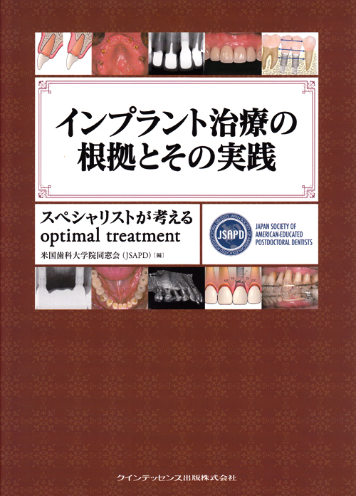 インプラント治療の根拠とその実践 インプラント治療の根拠とその実践 - クインテッセンス出版
