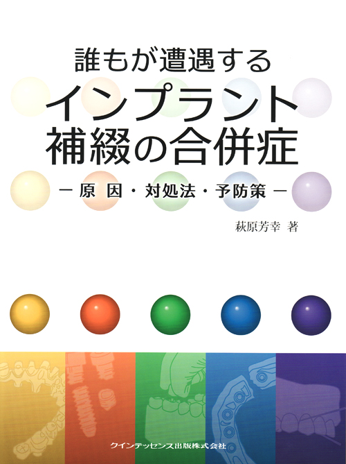 誰もが遭遇するインプラント補綴の合併症 シエン社 | 誰もが遭遇するインプラント補綴の合併症