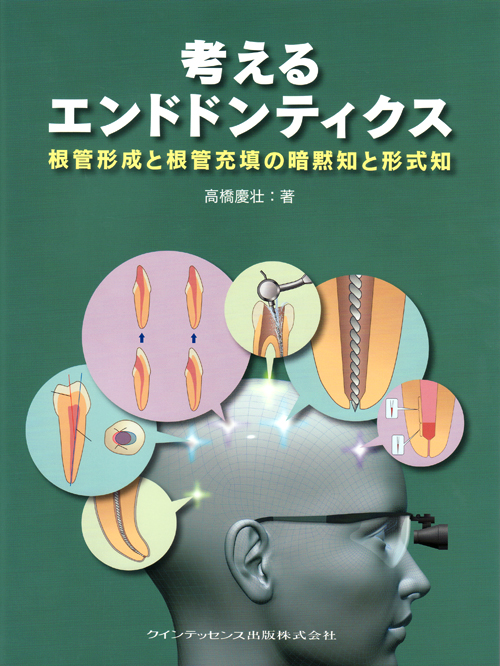 考えるエンドドンティクス | 高橋 慶壮 |本 | 通販 | Amazon