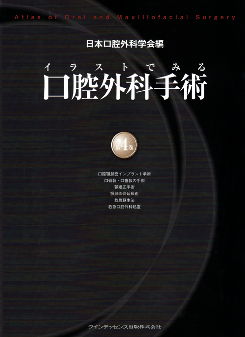 シエン社 | イラストでみる口腔外科手術 [第4巻]