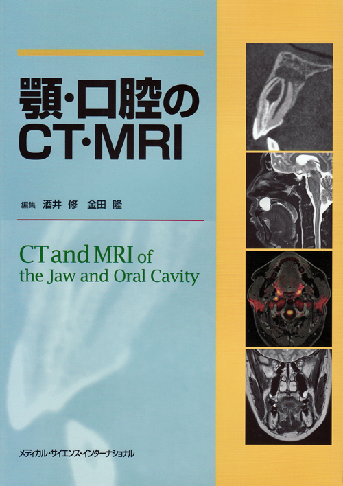 シエン社 | 顎・口腔のCT・MRI