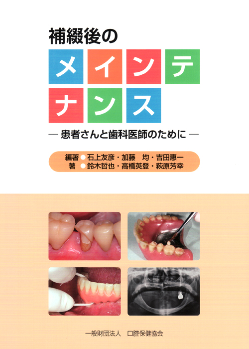 歯周・補綴のメインテナンス シエン社 | 補綴後のメインテナンス
