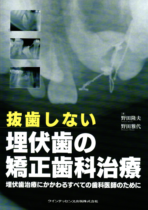 シエン社 | 抜歯しない埋伏歯の矯正歯科治療