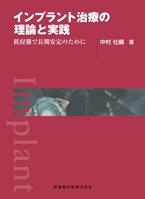 ITIインプラントの理論と実際 シエン社 | インプラント治療の理論と実践