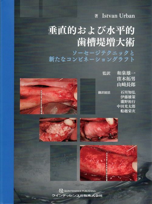 シエン社 | 垂直的および水平的歯槽堤増大術