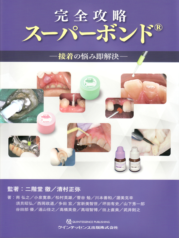 完全攻略スーパーボンドR ―接着の悩み即解決
