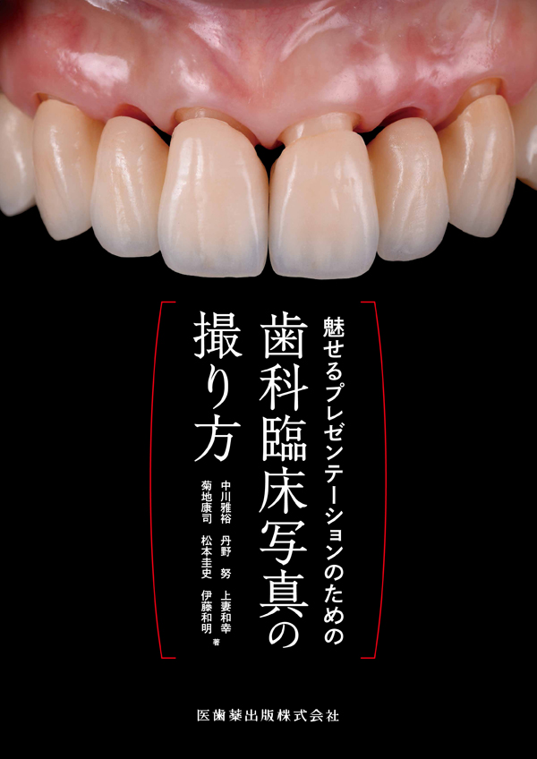 シエン社 | 魅せるプレゼンテーションのための歯科臨床写真の撮り方