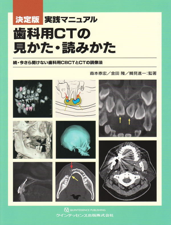 シエン社 | 決定版 実践マニュアル 歯科用CTの見かた・読みかた