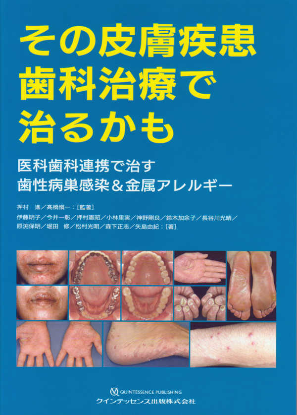 シエン社 | その皮膚疾患 歯科治療で治るかも