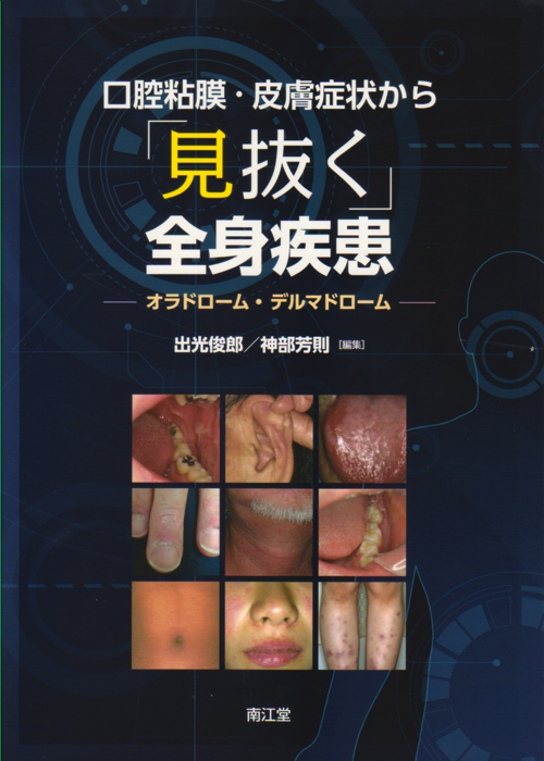 口腔粘膜・皮膚症状から「見抜く」全身疾患【電子版】 | 医書.jp