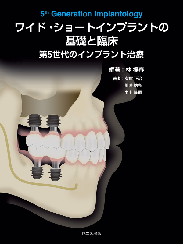 ワイド•ショートインプラントの基礎と臨床