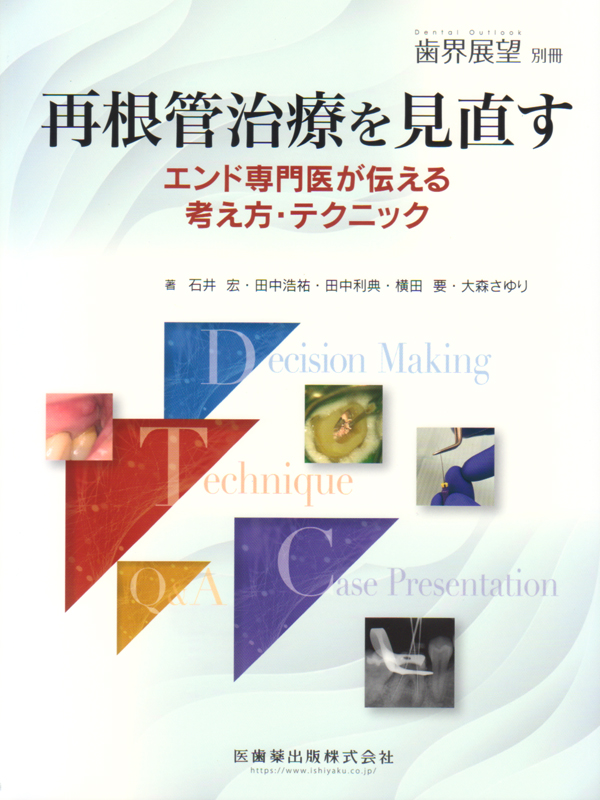 シエン社 | 再根管治療を見直す