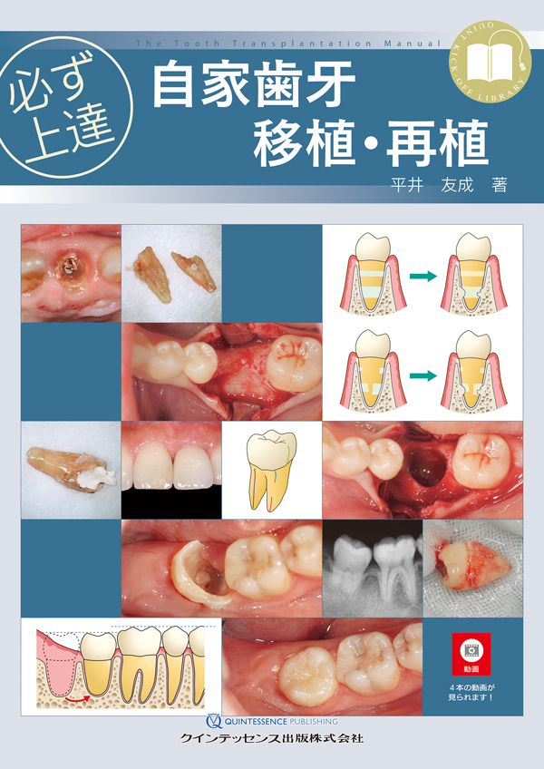 シエン社 | 必ず上達 自家歯牙移植・再植