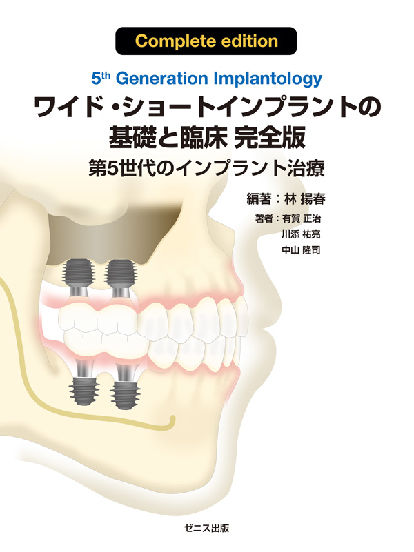 ワイド•ショートインプラントの基礎と臨床