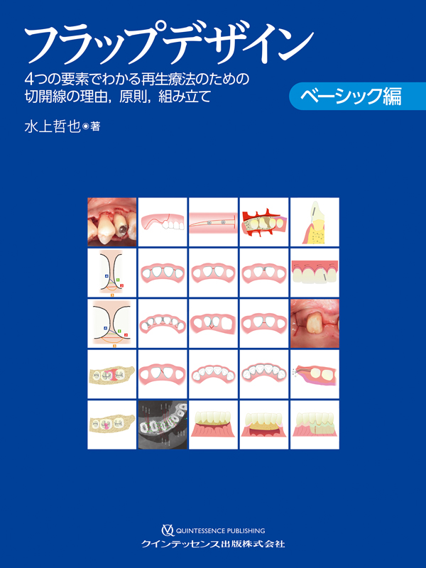 裁断済み】フラップデザイン 4つの要素でわかる再生療法のため