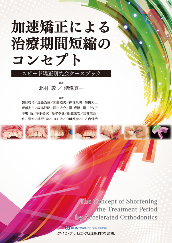 加速矯正による治療期間短縮のコンセプト - シエン社 加速矯正による治療期間短縮のコンセプト - シエン社