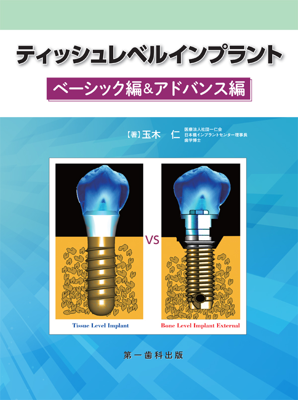 シエン社 | ティッシュレベルインプラント