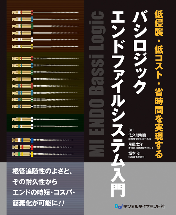 未来工業 ボックスアッター （金属探知器） BUT-1N : エヌデン
