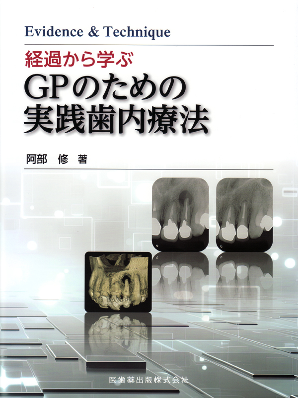 Evidence & Technique NiTiロータリーファイルを効果的に使う