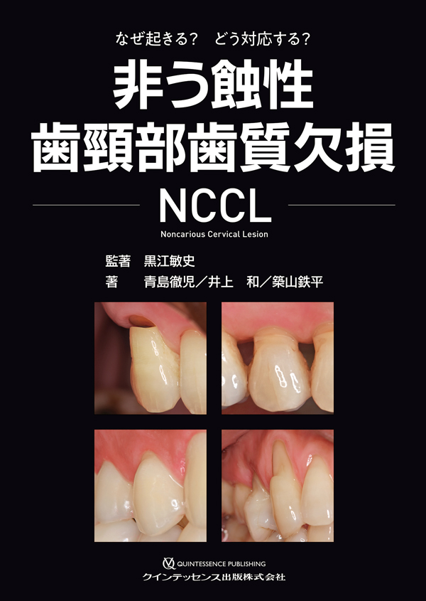 【即日発送】知る・診る・対応する 酸蝕症 知る・診る・対応する 酸蝕症｜医学、薬学、看護
