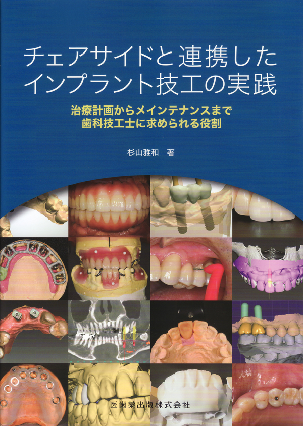 チェアサイドと連携したインプラント技工の実践 治療計画から