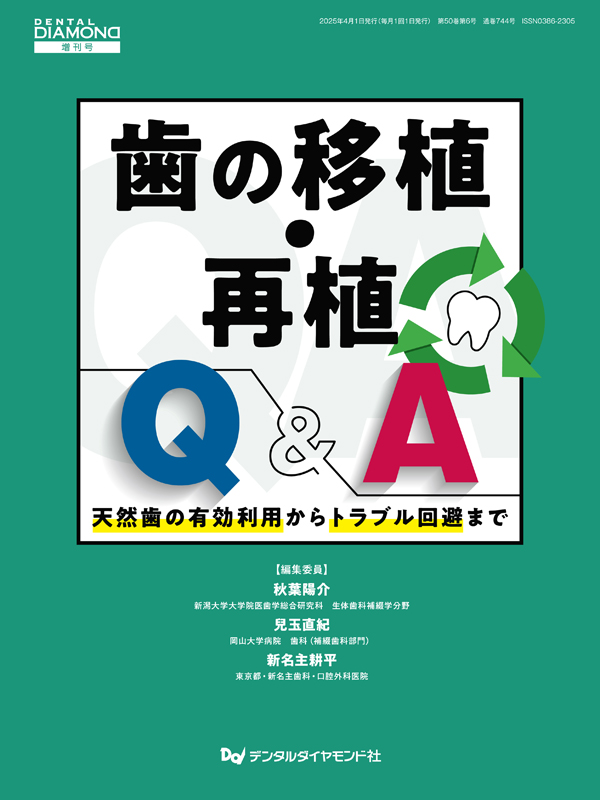 歯の移植・再植Q&A 天然歯の有効利用からトラブル回避まで