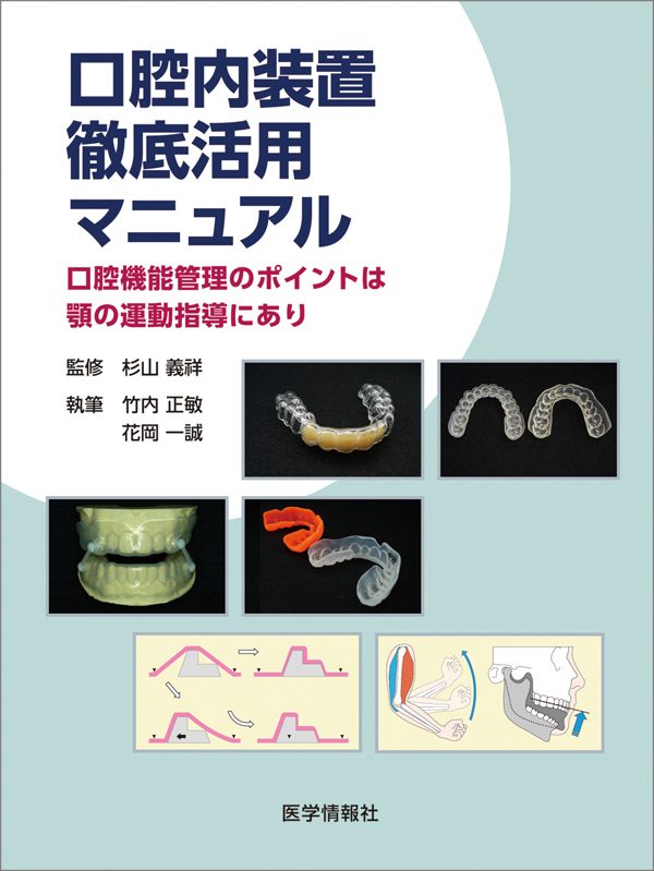 無理なくできる骨造成導入マニュアル