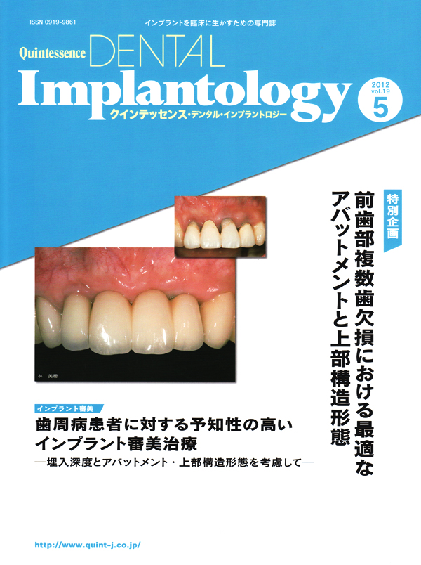 シングル・トゥース インプラント シングル・トゥースインプラント: 前歯部および臼歯部抜歯窩
