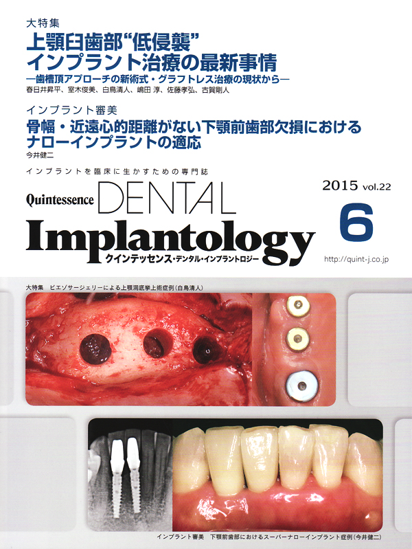 エビデンス・ベースト・インプラントロジー 41bAik1BJLL.jpg_BO30,255,255,